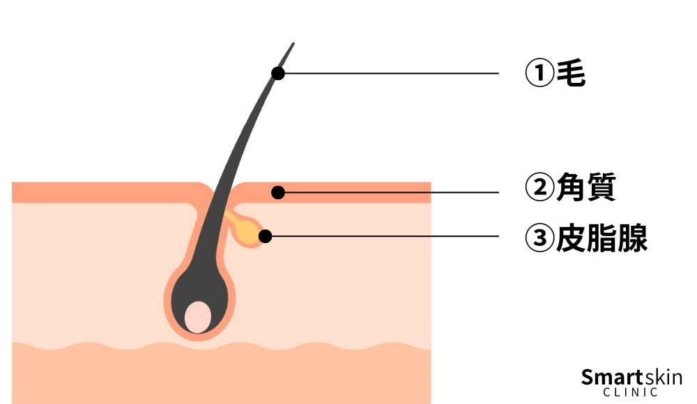 Pore structure